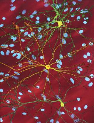 Several neurons colored yellow and having a large central core with up to two dozen tendrils branching out of them, the core of the neuron in the foreground contains an orange blob about a quarter of its diameter